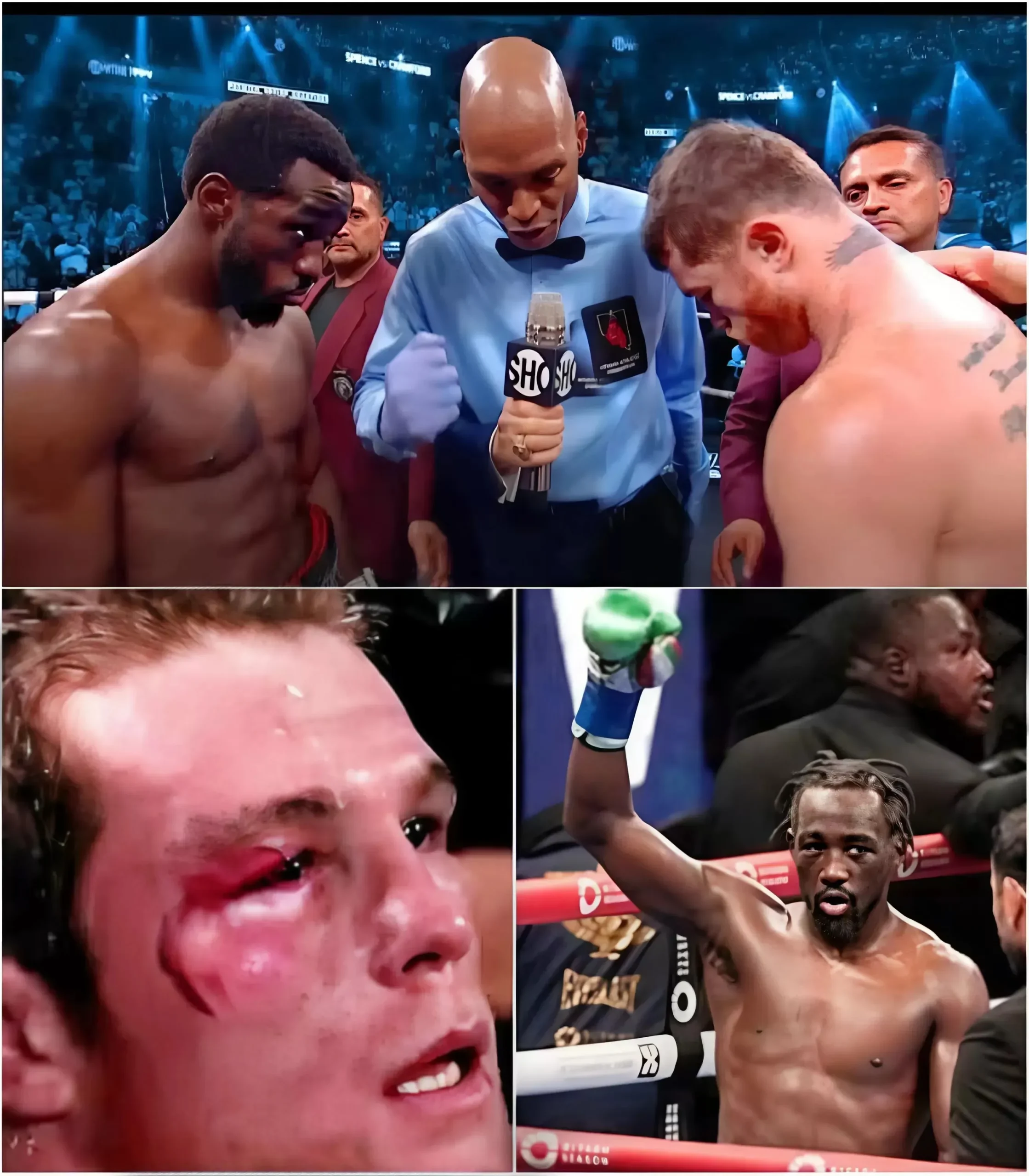 Cover Image for AWESOME! Canelo Alvarez suffers a devastating knockout by Terence Crawford – “The King” collapses in the ring for 25 minutes!